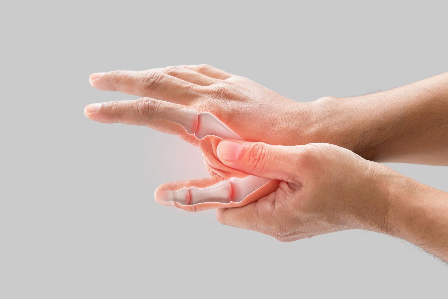 Arthritis
